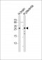 CHMP4A Antibody (C-term)